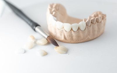 Teeth Whitening Costs: Do Individual Goals Affect Them?